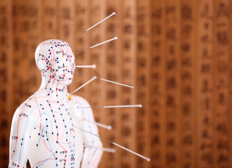 Acupuncture Nottingham