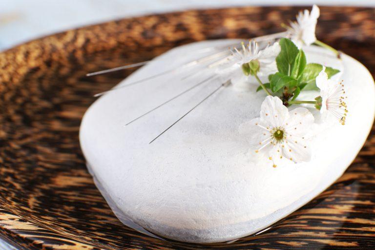 Acupuncture West Bridgford Nottingham